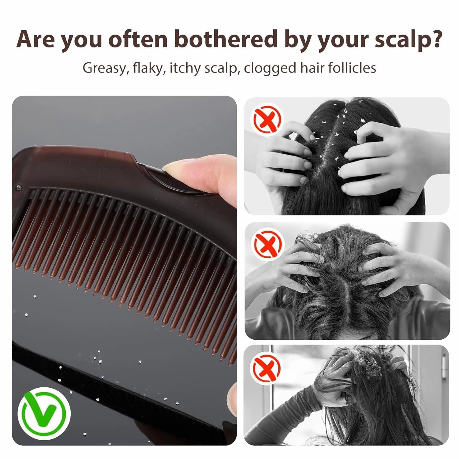 Dandruff Comb, Hollow Tooth Button Comb, Detoxing Comb Energy Massage Comb, Scalp Psoriasis Comb Dandruff Removal Comb, Lice Comb Multifunctional Hairbrush for Women Men Kids